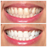 AP24 Whitening Fluoride Toothpaste
